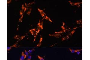 Immunofluorescence analysis of HeLa cells using IL18 Polyclonal Antibody at dilution of 1:100. (IL-18 antibody)