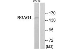 Western blot analysis of extracts from COLO cells, using RGAG1 Antibody. (RGAG1 antibody  (AA 1331-1380))