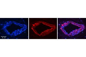 Rabbit Anti-ESD Antibody Catalog Number: ARP58619_P050 Formalin Fixed Paraffin Embedded Tissue: Human Heart Tissue Observed Staining: Cytoplasm in endothelial and smooth muscle cells in arterioles Primary Antibody Concentration: 1:100 Other Working Concentrations: 1:600 Secondary Antibody: Donkey anti-Rabbit-Cy3 Secondary Antibody Concentration: 1:200 Magnification: 20X Exposure Time: 0. (Esterase D antibody  (N-Term))