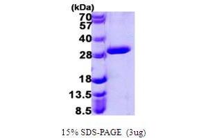 SDS-PAGE (SDS) image for Uroporphyrinogen III Synthase (UROS) (AA 1-265) protein (His tag) (ABIN667456)