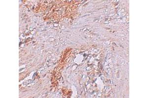 Immunohistochemical staining of human colon cells with RBM35A polyclonal antibody  at 2.