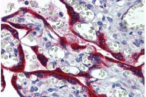 Human Placenta: Formalin-Fixed, Paraffin-Embedded (FFPE) (Fibrillin 1 antibody  (AA 2772-2872))