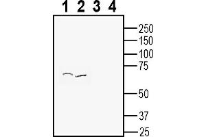 Western blot analysis of rat kidney membranes (lanes 1 and 3) and mouse kidney membranes (lanes 2 and 4): 1, 2.