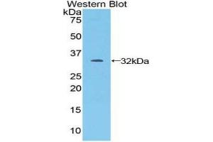 Western Blotting (WB) image for anti-Janus Kinase 1 (JAK1) (AA 596-841) antibody (ABIN1859522) (JAK1 antibody  (AA 596-841))