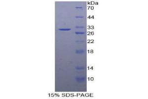 SDS-PAGE analysis of Human NOSIP Protein. (NOSIP Protein)