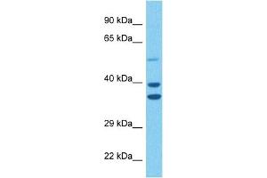 Western Blotting (WB) image for anti-Lactate Dehydrogenase B (LDHB) (C-Term) antibody (ABIN2783283)