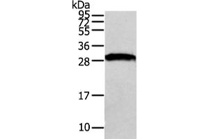 Western Blotting (WB) image for anti-VAMP (Vesicle-Associated Membrane Protein)-Associated Protein A, 33kDa (VAPA) antibody (ABIN5962090) (VAPA antibody)