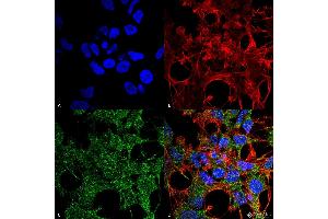 Immunocytochemistry/Immunofluorescence analysis using Rabbit Anti-GABARAP Polyclonal Antibody . (GABARAP antibody  (N-Term) (APC))