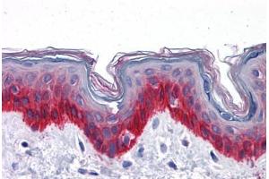 Human Skin: Formalin-Fixed, Paraffin-Embedded (FFPE) (KRT81 antibody  (AA 1-203))