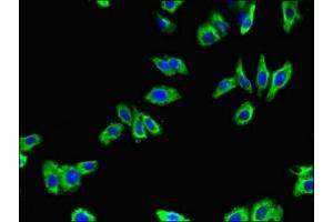 Immunofluorescent analysis of HepG2 cells using ABIN7145355 at dilution of 1:100 and Alexa Fluor 488-congugated AffiniPure Goat Anti-Rabbit IgG(H+L) (ADRB1 antibody  (AA 401-477))