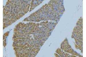 Immunohistochemistry (IHC) image for anti-Intercellular Adhesion Molecule 1 (ICAM1) (C-Term) antibody (ABIN6262433)