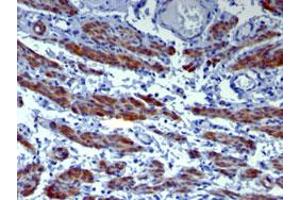 Immunohistochemical staining (Formalin-fixed paraffin-embedded sections) of human uterus with CALD1 monoclonal antibody, clone h-CALD . (Caldesmon antibody)