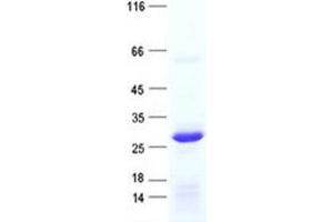 Validation with Western Blot (RPL10L Protein (His tag))