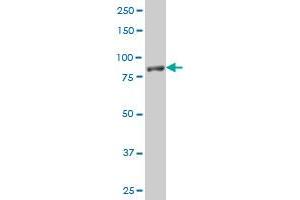 NLGN1 polyclonal antibody (A01), Lot # UTO6060209QCS1 Western Blot analysis of NLGN1 expression in Jurkat (Neuroligin 1 antibody  (AA 578-677))