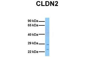 Host:  Rabbit  Target Name:  CLDN2  Sample Tissue:  Human MCF7  Antibody Dilution:  1. (Claudin 2 antibody  (N-Term))