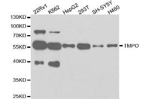 Western blot analysis of extracts of various cell lines, using TMPO antibody. (Thymopoietin antibody  (AA 1-410))