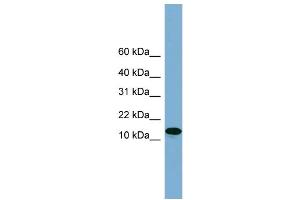 WB Suggested Anti-H2AFX  Antibody Titration: 0. (H2AFX antibody  (Middle Region))