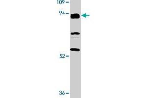 Western blot analysis of TLR3 expression in K-562 cell lysate with TLR3 polyclonal antibody  at 2 ug/mL .