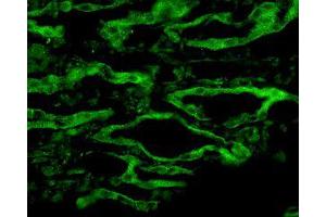 Aquaporin 4 Immunofluorescence. (Aquaporin 4 antibody  (C-Term))