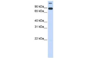 TMEM48 antibody used at 1 ug/ml to detect target protein. (TMEM48 antibody  (Middle Region))