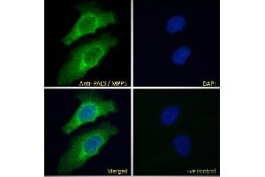 ABIN185150 Immunofluorescence analysis of paraformaldehyde fixed HeLa cells, permeabilized with 0. (MPP5 antibody  (N-Term))
