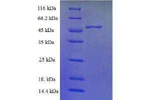SDS-PAGE (SDS) image for Trimethyllysine Hydroxylase, epsilon (TMLHE) (AA 16-376) protein (His tag) (ABIN4976237)