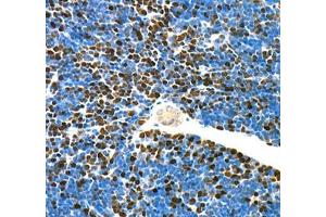 Immunohistochemistry (Paraffin-embedded Sections) (IHC (p)) image for anti-Topoisomerase (DNA) II alpha 170kDa (TOP2A) antibody (ABIN7075937)