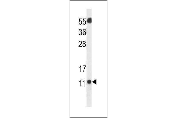 SH3BGRL3抗体（AA 24-52）