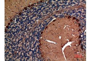 Immunohistochemistry (IHC) image for anti-Aldolase C, Fructose-Bisphosphate (ALDOC) (N-Term) antibody (ABIN3187723)