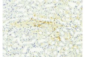ABIN6276461 at 1/100 staining Mouse kidney tissue by IHC-P.