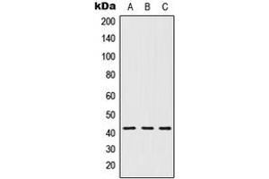 Western blot analysis of 5-HT1D expression in MCF7 (A), Raw264. (5HT1D antibody  (Center))
