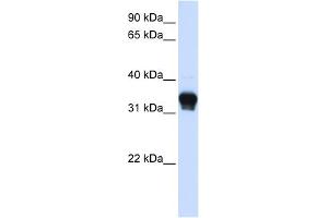 WB Suggested Anti-CSNK1A1 Antibody Titration: 0.