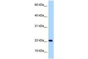 Image no. 1 for anti-Chromosome 9 Open Reading Frame 9 (C9ORF9) (AA 30-79) antibody (ABIN6748276) (C9orf9 antibody  (AA 30-79))