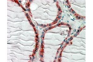 ABIN571023 (2. (CLIP1 antibody  (C-Term))