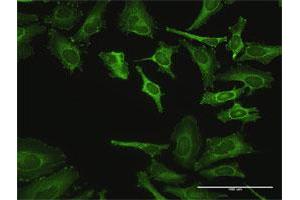Immunofluorescence of purified MaxPab antibody to ZYX on HeLa cell. (ZYX antibody  (AA 1-572))