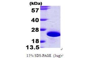 SDS-PAGE (SDS) image for Neuronal Calcium Sensor 1 (NCS1) (AA 1-190) protein (His tag) (ABIN666974)
