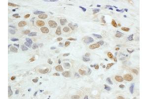 Immunohistochemistry (IHC) image for anti-Jun B Proto-Oncogene (JUNB) (AA 1-40) antibody (ABIN7454852)