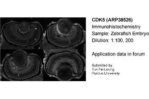 Sample Type: Zebrafish EmbryoDilution: 1:100, 1:200 (CDK5 antibody  (C-Term))