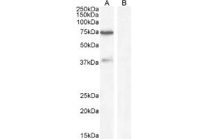 ABIN570947 (1µg/ml) staining of Human Cerebellum lysate (A) + Blocking peptide (B) (35µg protein in RIPA buffer). (WIZ antibody  (Internal Region))