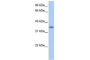 WB Suggested Anti-C17orf39 Antibody Titration: 0. (GID4 antibody  (C-Term))