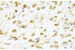 Immunohistochemistry of paraffin-embedded Mouse brain using VAPB Polyclonal Antibody at dilution of 1:200 (40x lens).