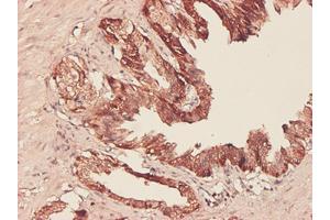 Immunohistochemistry (Formalin-fixed Paraffin-embedded Sections) (IHC (fp)) image for anti-phosphoglycerate Dehydrogenase (PHGDH) (AA 1-533) antibody (ABIN565240)