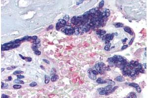 Placenta, serum, Human: Formalin-Fixed, Paraffin-Embedded (FFPE) (Hemopexin antibody  (AA 32-45))