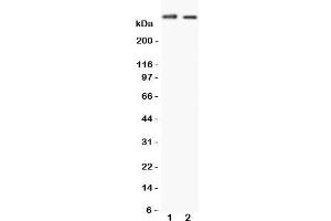 Western blot testing of Huntingtin antibody and Lane 1:  HeLa (Huntingtin antibody  (C-Term))