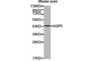Western Blotting (WB) image for anti-Major Intrinsic Protein of Lens Fiber (MIP) antibody (ABIN1873696) (MIP antibody)