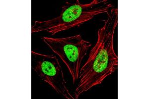 Fluorescent image of Hela cells stained with SBP Antibody (Center) C.