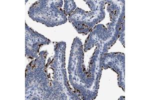 Immunohistochemical staining (Formalin-fixed paraffin-embedded sections) of human fallopian tube with RINT1 polyclonal antibody  shows strong membranous positivity in ciliated glandular cells.