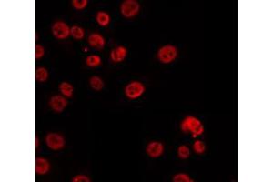 ABIN6274846 staining HuvEc by IF/ICC. (CDKN2AIP antibody  (Internal Region))