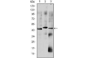 Western blot analysis using OTX2 mouse mAb against HepG2 (1), Jurkat (2), and NTERA-2 (3) cell lysate. (OTX2 antibody)