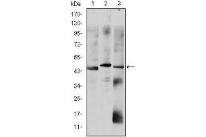 OTX2 antibody